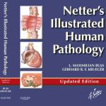 Netter’s Illustrated Human Pathology SECOND EDITION pdf book free download