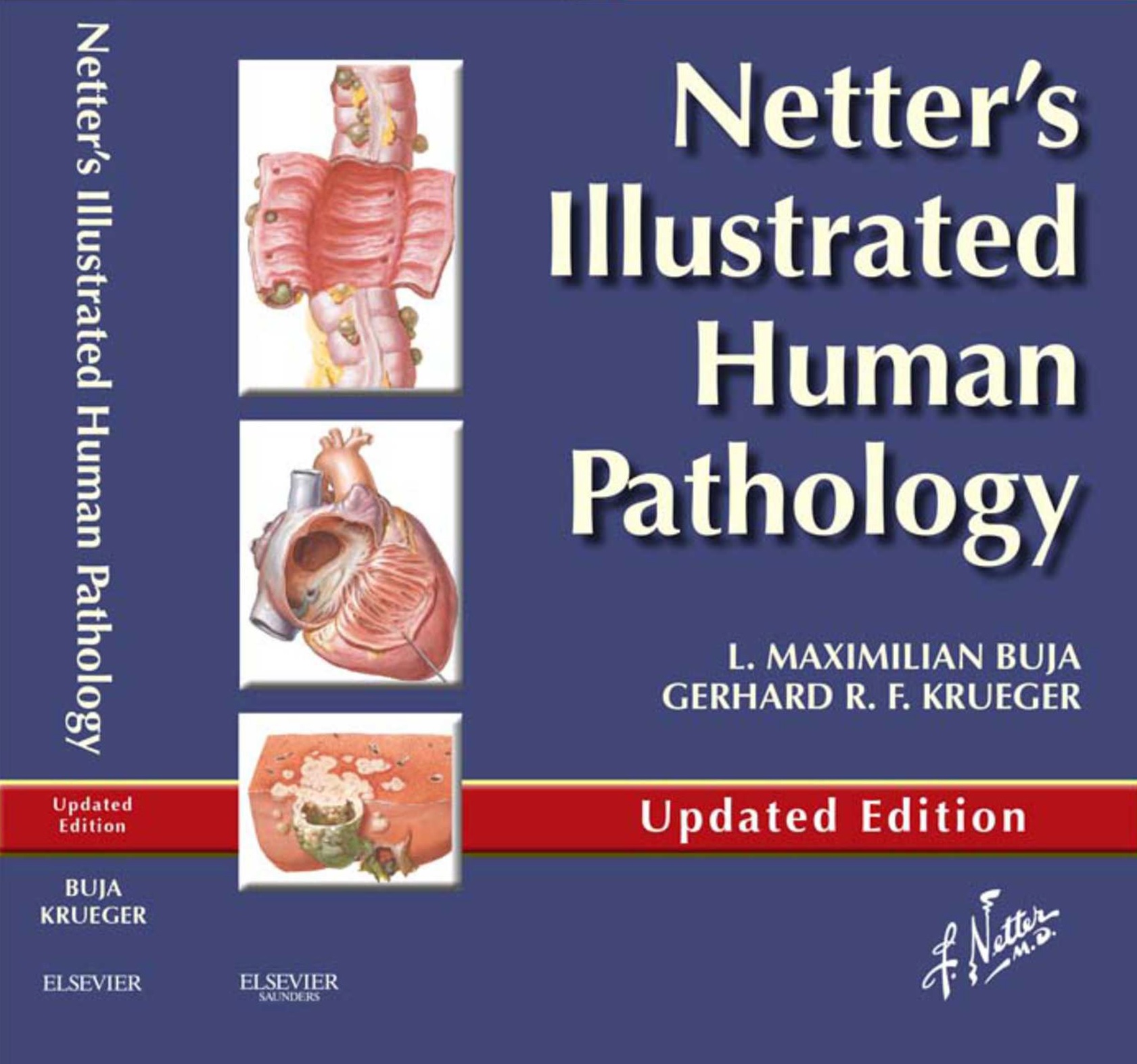 Netter’s Illustrated Human Pathology SECOND EDITION pdf book free download