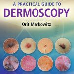 A Practical Guide to Dermoscopy pdf book free download