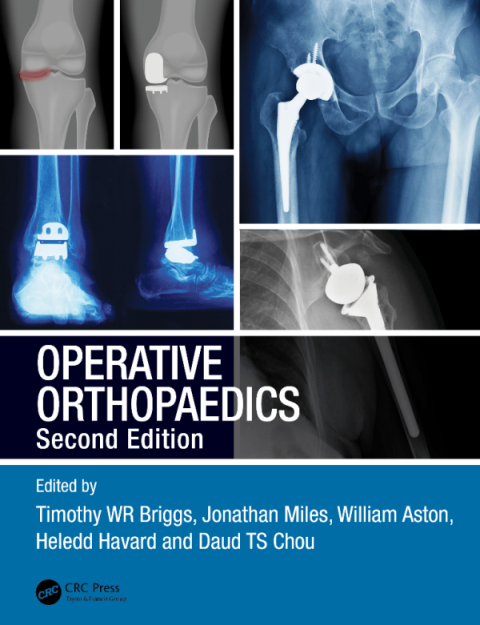 OPERATIVE ORTHOPAEDICS second edition by Timothy WR Briggs pdf book free download