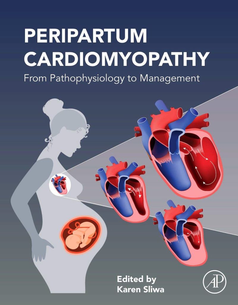 Peripartum Cardiomyopathy pdf book free download