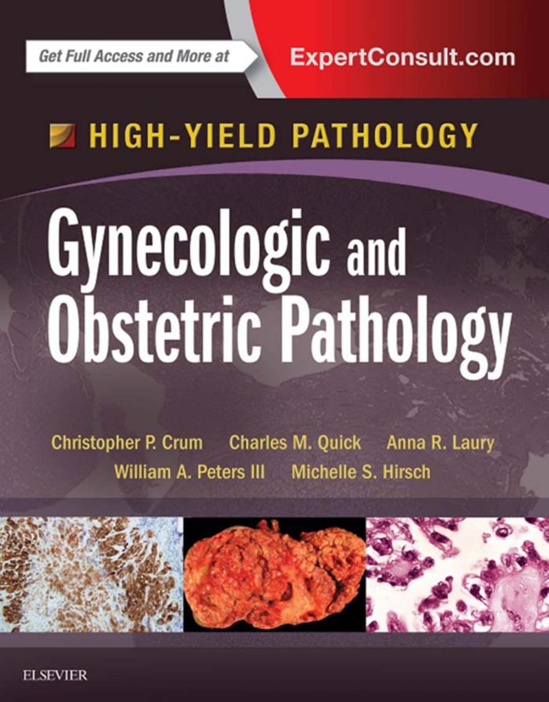 Gynecologic and Obstetric Pathology High Yield Pathology pdf book free download