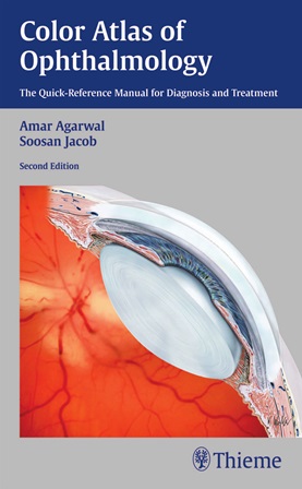 Color Atlas of Ophthalmology pdf books free download